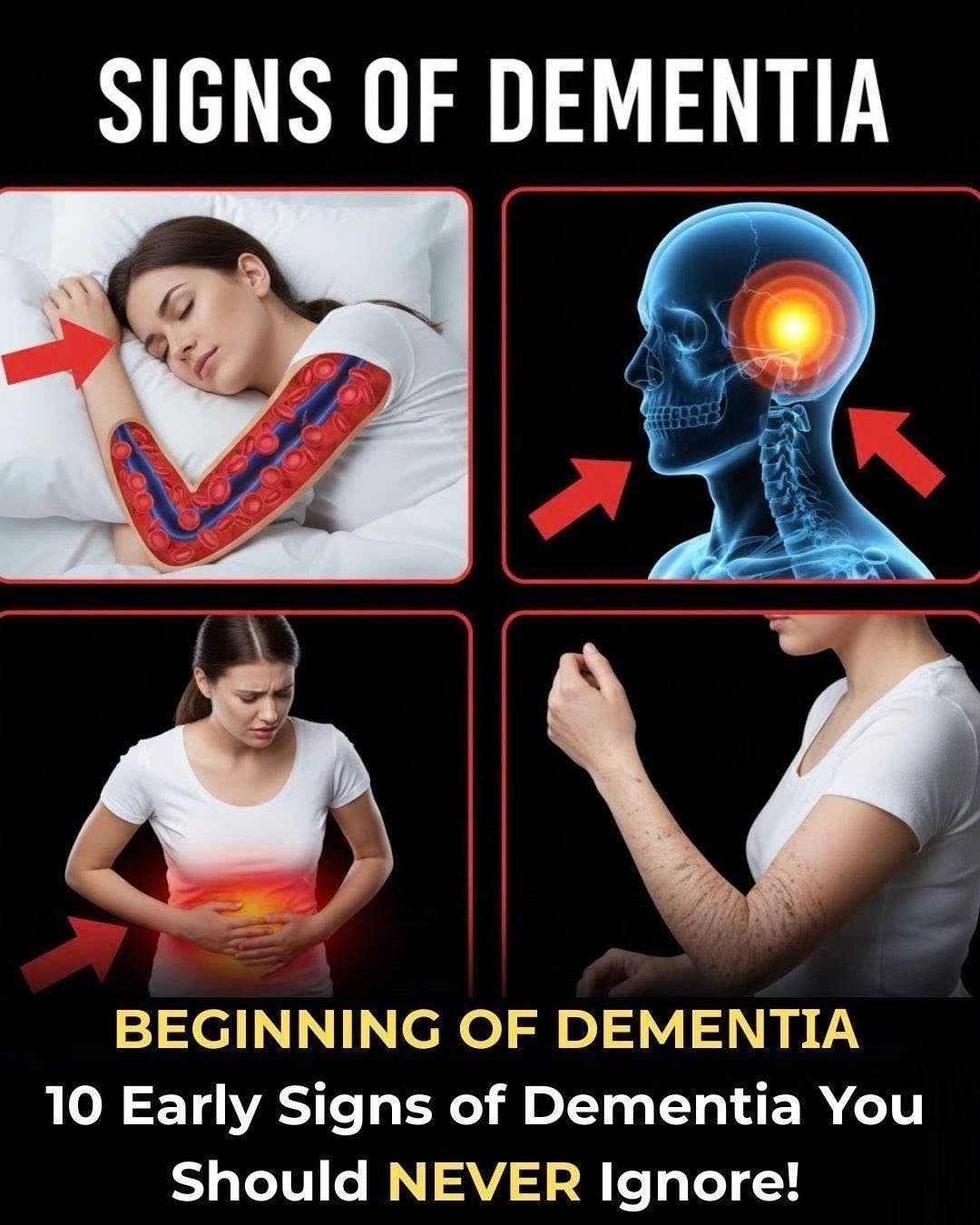 Early Signs of Dementia: What to Notice, What to Do, and Why It Matters