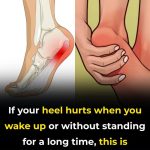 7 Exercises to Help Relieve Heel Discomfort and Support Foot Health