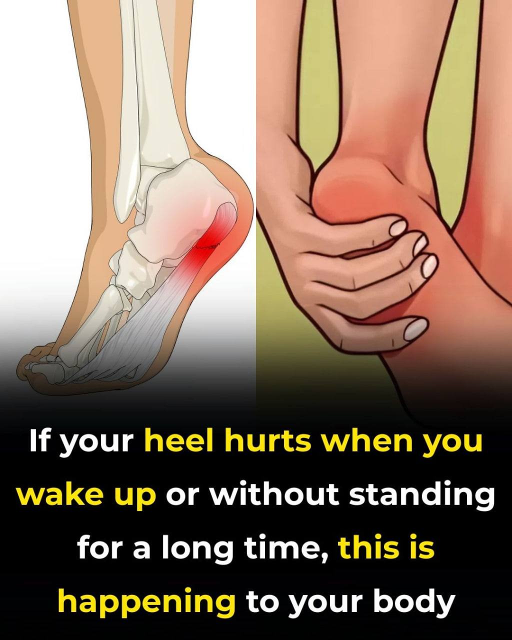 7 Exercises to Help Relieve Heel Discomfort and Support Foot Health