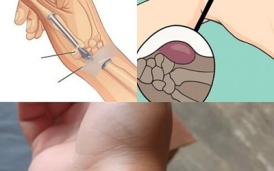 Healing Power and Important Safety Tips for Castor Leaves