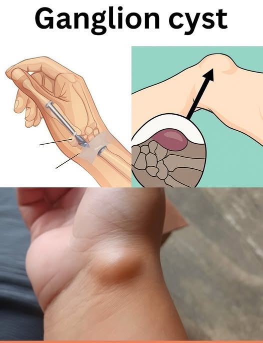Healing Power and Important Safety Tips for Castor Leaves
