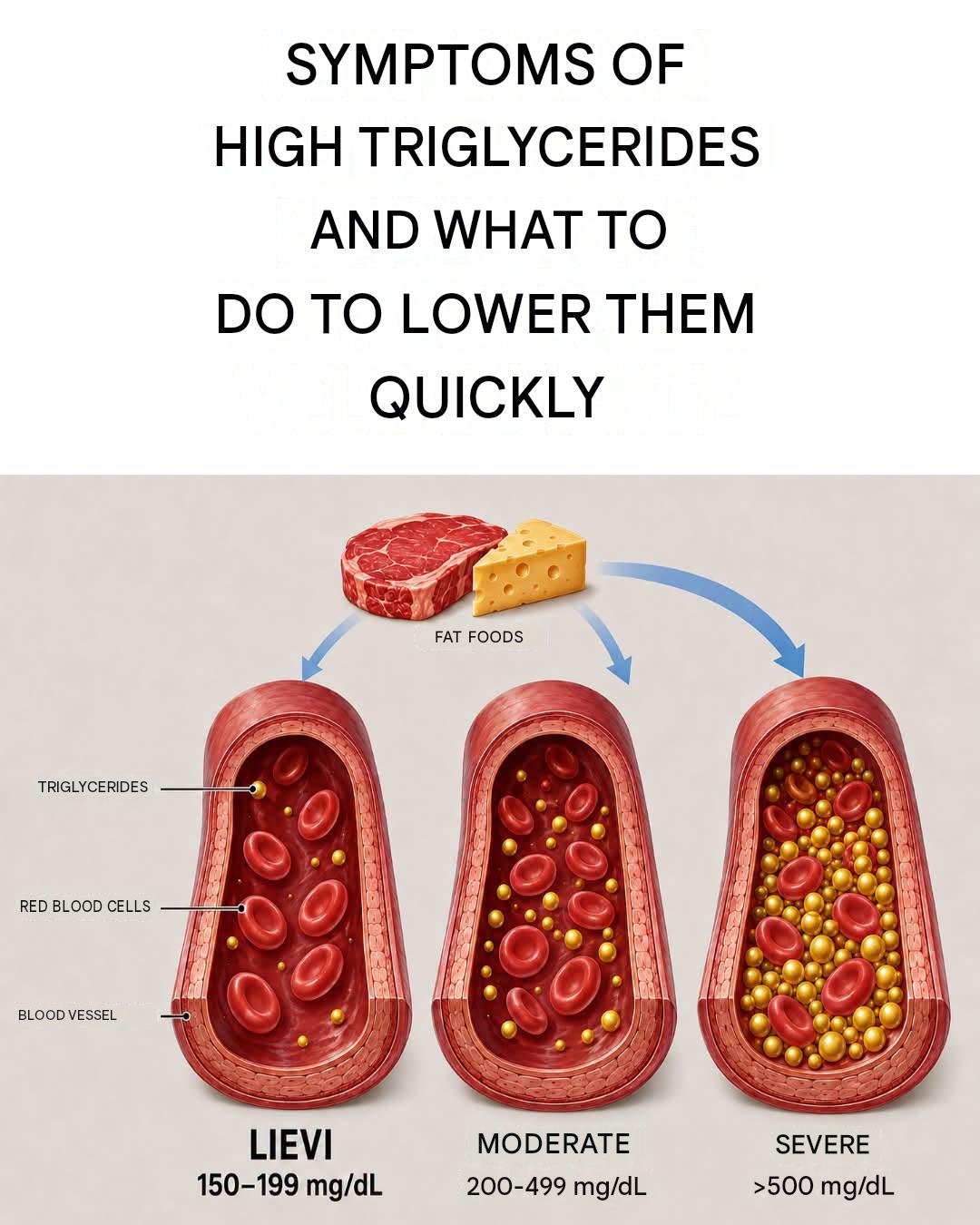 Symptoms and causes of high triglycerides, and how to lower them quickly
